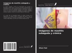 Imágenes de mastitis subaguda y crónica的封面