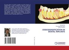 Bookcover of OSSEODENSIFICATION IN DENTAL IMPLANTS