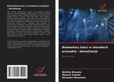 Buchcover von Biomarkery kości w chorobach przyzębia - aktualizacja