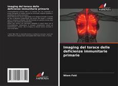 Imaging del torace delle deficienze immunitarie primarie kitap kapağı
