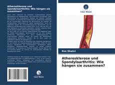 Copertina di Atherosklerose und Spondyloarthritis: Wie hängen sie zusammen?