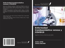Enfermedad tromboembólica venosa y COVID19的封面