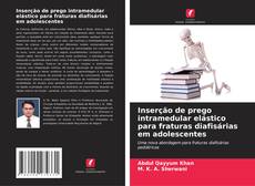 Couverture de Inserção de prego intramedular elástico para fraturas diafisárias em adolescentes