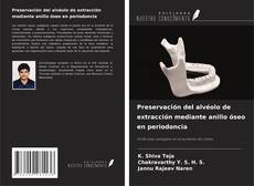 Couverture de Preservación del alvéolo de extracción mediante anillo óseo en periodoncia