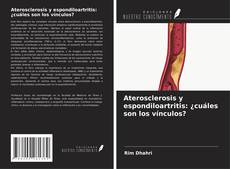 Aterosclerosis y espondiloartritis: ¿cuáles son los vínculos?的封面