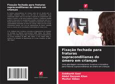 Borítókép a  Fixação fechada para fraturas supracondilianas do úmero em crianças - hoz