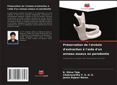 Bookcover of Préservation de l'alvéole d'extraction à l'aide d'un anneau osseux en parodontie