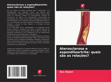 Обложка Aterosclerose e espondiloartrite: quais são as relações?