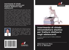 Inserimento di chiodo intramidollare elastico per fratture diafisarie negli adolescenti的封面
