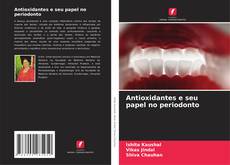 Antioxidantes e seu papel no periodonto的封面
