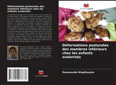 Déformations posturales des membres inférieurs chez les enfants scolarisés的封面