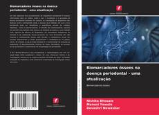 Buchcover von Biomarcadores ósseos na doença periodontal - uma atualização