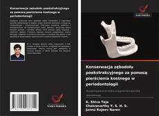 Buchcover von Konserwacja zębodołu poekstrakcyjnego za pomocą pierścienia kostnego w periodontologii