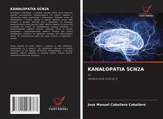 Portada del libro de KANAŁOPATIA SCN2A