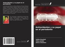 Buchcover von Antioxidantes y su papel en el periodonto