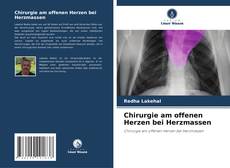 Copertina di Chirurgie am offenen Herzen bei Herzmassen