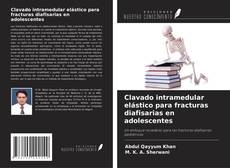 Clavado intramedular elástico para fracturas diafisarias en adolescentes的封面