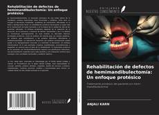 Copertina di Rehabilitación de defectos de hemimandibulectomía: Un enfoque protésico