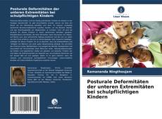 Bookcover of Posturale Deformitäten der unteren Extremitäten bei schulpflichtigen Kindern