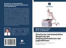 Copertina di Elastische intramedulläre Nagelung bei Diaphysenfrakturen bei Jugendlichen