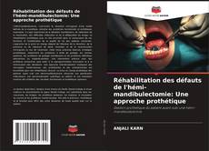 Couverture de Réhabilitation des défauts de l'hémi-mandibulectomie: Une approche prothétique
