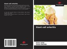 Buchcover von Giant cell arteritis