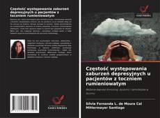 Bookcover of Częstość występowania zaburzeń depresyjnych u pacjentów z toczniem rumieniowatym