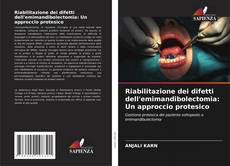 Buchcover von Riabilitazione dei difetti dell'emimandibolectomia: Un approccio protesico