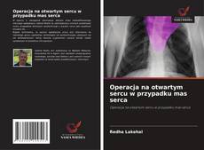 Buchcover von Operacja na otwartym sercu w przypadku mas serca