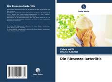 Die Riesenzellarteriitis kitap kapağı