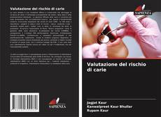 Portada del libro de Valutazione del rischio di carie