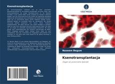 Portada del libro de Ksenotransplantacja