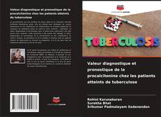Bookcover of Valeur diagnostique et pronostique de la procalcitonine chez les patients atteints de tuberculose