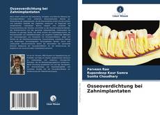 Buchcover von Osseoverdichtung bei Zahnimplantaten