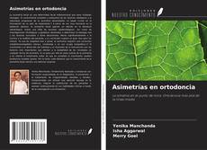 Couverture de Asimetrías en ortodoncia