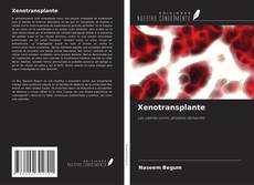Bookcover of Xenotransplante