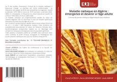 Couverture de Maladie cœliaque en Algérie : émergence et devenir à l’âge adulte