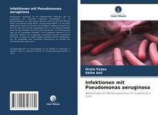 Copertina di Infektionen mit Pseudomonas aeruginosa