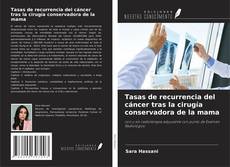 Tasas de recurrencia del cáncer tras la cirugía conservadora de la mama kitap kapağı