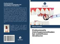 Copertina di Professionelle Zahnhygienemethoden bei metallfreien Strukturen