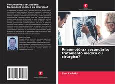 Capa do livro de Pneumotórax secundário: tratamento médico ou cirúrgico? 