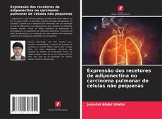 Bookcover of Expressão dos recetores de adiponectina no carcinoma pulmonar de células não pequenas
