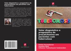 Buchcover von Valor diagnóstico e prognóstico da procalcitonina em pacientes com tuberculose