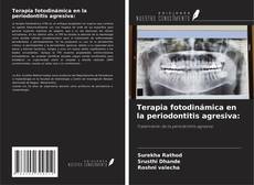 Copertina di Terapia fotodinámica en la periodontitis agresiva: