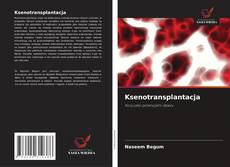 Ksenotransplantacja kitap kapağı