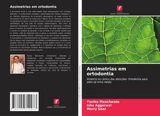 Bookcover of Assimetrias em ortodontia