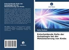 Copertina di Entscheidende Rolle der Autophagie bei der Metastasierung von Krebs