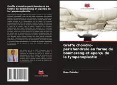 Greffe chondro-perichondrale en forme de boomerang et aperçu de la tympanoplastie的封面