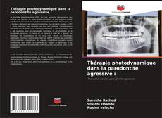 Bookcover of Thérapie photodynamique dans la parodontite agressive :