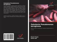 Bookcover of Zakażenia Pseudomonas aeruginosa